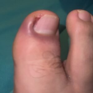 uñeros ok
