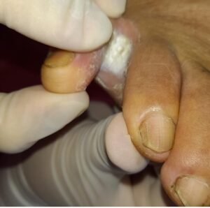 DERMATOMICOSIS 4