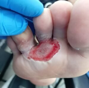 HERIDAS 7