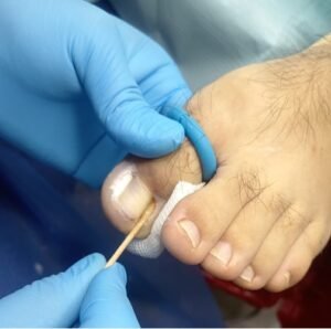 MATRICETOMIA QUIMICA 16